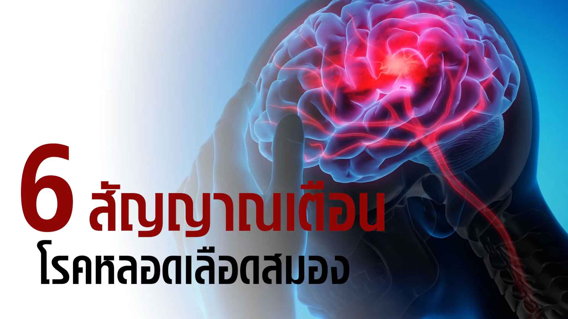 6 สัญญาณเตือน โรคหลอดเลือดสมอง